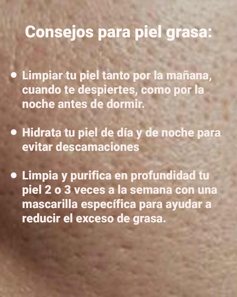 Piel Grasa